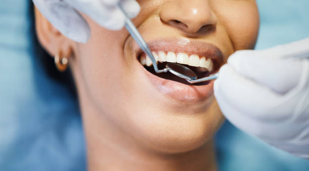 Best Emergency Dental Extractions in Monroe, MI