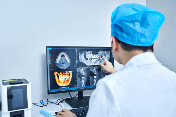 Best Emergency Dentist for Lost Fillings or Crowns in Monroe, MI